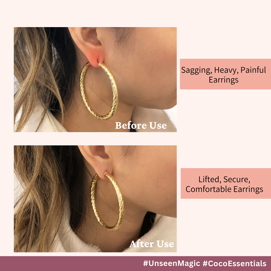 Earlobe Patches